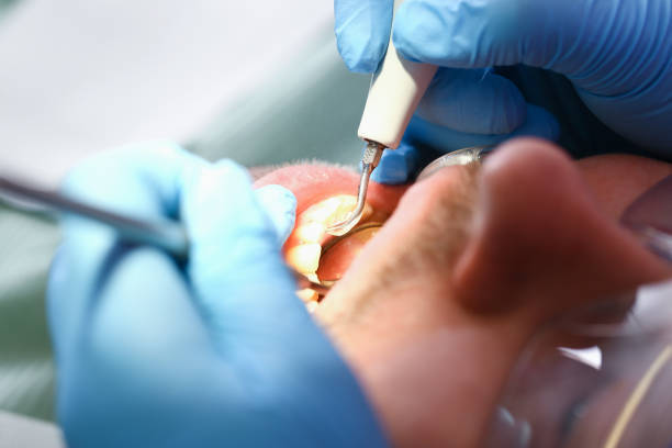 Best Cracked Tooth Emergency Dentist  in Penn Valley, CA